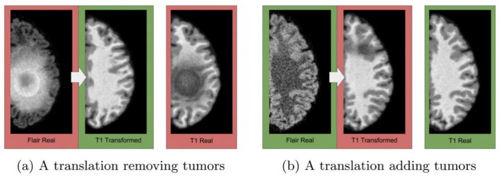 Fig. 8 Removal and Addition of Tumor due to Synthetic Data Errors